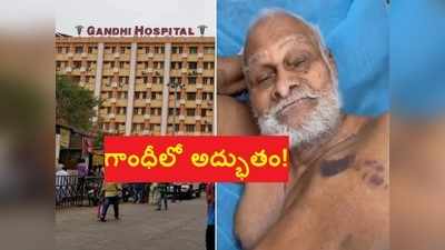 గాంధీ హాస్పిటల్‌లో అద్భుతం! డాక్టర్లు సైతం అవాక్కు.. దేశంలోనే ఇదో రికార్డు 