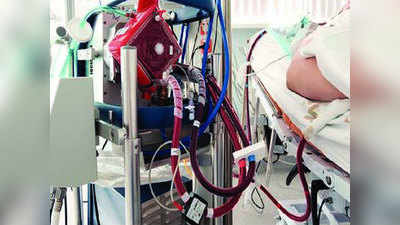 लाइफ सपोर्ट के लिए ECMO की भी बढ़ने लगी डिमांड, क्या है यह, कब होता है इस्तेमाल, जानें सबकुछ