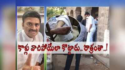 నా కాళ్లు వాచిపోయేలా కొట్టారు, నిన్న రాత్రంతా.. ఎంపీ రఘురామ కృష్ణరాజు సంచలనం