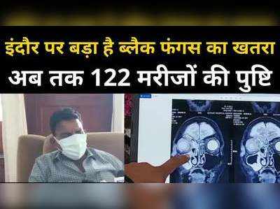 डरा रहे हैं इंदौर के आंकड़े, ब्लैक फंगस के मरीजों की संख्या पहुंची 122, मंत्री ने कहा, चिंता की बात नहीं