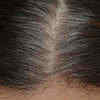 Premature White and Grey Hair in Children Causes  Home Remedies