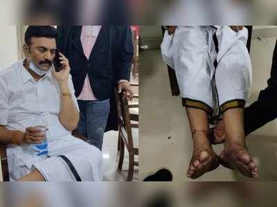 MP RRR Case: రఘురామకు చిత్రహింసలు నిజమే.. ఆర్మీ ఆస్పత్రి సంచలన నివేదిక