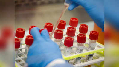 Antibody Test: कोरोना के बाद क्या बन रही है ऐंटीबॉडी? DRDO के किट से केवल 75 रुपये में हो सकेगी जांच