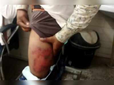 Raebareli news: रायबरेली में तिलक चढ़ा कर आ रहे लोगों की पुलिस ने की जमकर की पिटाई