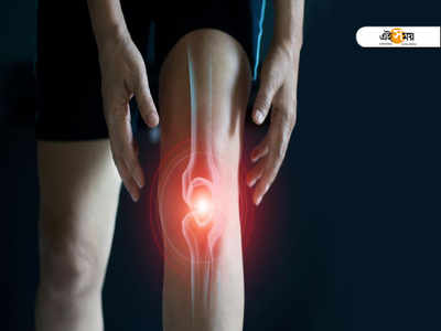 Knee Pain Home Remedy: ১ মিনিটে দূর হবে হাঁটু ব্যথা, রইল ঘরোয়া অব্যর্থ দাওয়াই...