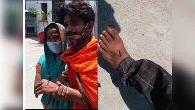 Bareilly News: युवक के हाथ और पैरों में घोंपी कीलें, पुलिस पर आरोप, SSP बोले- जांच में मामला झूठा