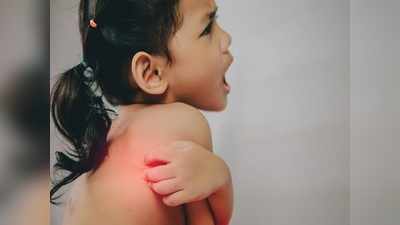 Eczema in babies and toddlers : गर्मी में बच्‍चे की फुंसियां नहीं हो रही हैं ठीक, ध्‍यान से देखें कहीं एक्जिमा तो नहीं, अभी ध्‍यान नहीं दिया तो लाइलाज हो सकती है