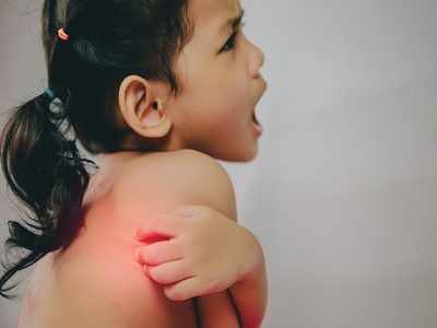 Eczema in babies and toddlers : गर्मी में बच्‍चे की फुंसियां नहीं हो रही हैं ठीक, ध्‍यान से देखें कहीं एक्जिमा तो नहीं, अभी ध्‍यान नहीं दिया तो लाइलाज हो सकती है