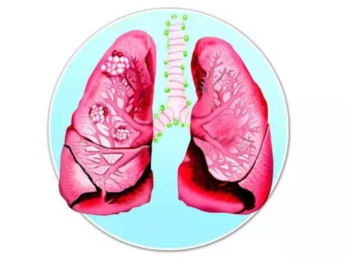 ​ஏன் மூச்சுத்திணறல்