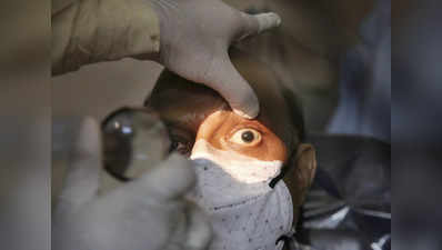 Black fungus in Eye: ब्लैक फंगस के कारण लखनऊ में निकालनी पड़ी 13 मरीजों की आंख, 17 और पर खतरा