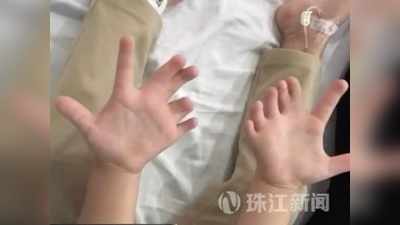 हाथ में 14 और पैर में 13 उंगलियों के साथ पैदा हुई थी लड़की, अब 4 साल की उम्र में ऑपरेशन