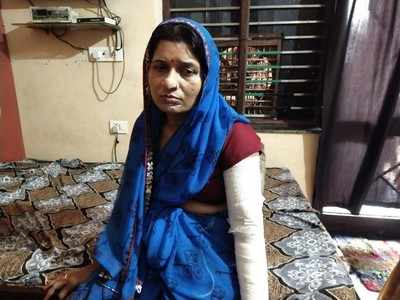 Agra Green gas news: ग्रीन गैस कंपनी की लापरवाही, आग में बुरी तरह झुलसी महिला