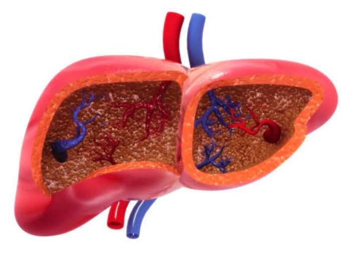 ​क्या है NAFLD? (फैटी लिवर रोग)