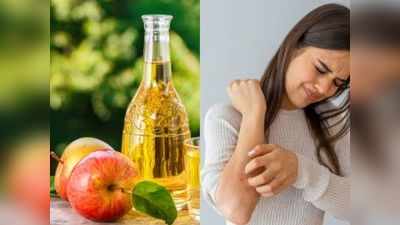 Itching Home Remedies: इन 8 घरेलू नुस्खों से मिनटों में दूर होगी खुजली और सूजन, बचेंगे पैसे और नहीं होगा इंफेक्शन