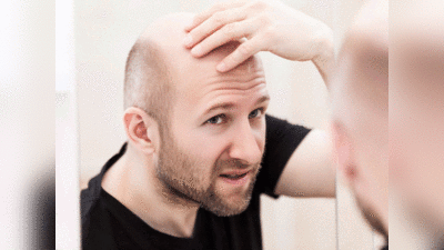 Baldness Cause And Cure: गंजापन पुरुषों को ही क्यों अधिक घेरता है? ये रहे 6 कारण और इनके समाधान