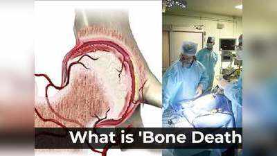 Bone Death : कोरोना से उबर चुके लोगों में सामने आ रहे बोन डेथ के मामले, जानें क्या है यह और कैसे कर रही प्रभावित