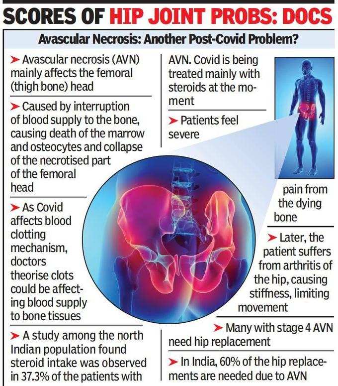 Post-Covid scourge? After mucormycosis, ‘bone death’ cases surging in Maharashtra: Doctors