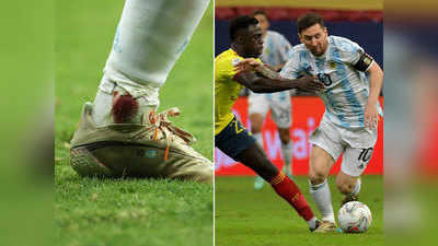Lionel Messi Bleeding Ankle: लाइव मैच में लगी चोट, टखने से टपक रहा था खून, फिर भी गोल दाग हीरो बने लियोनेल मेसी