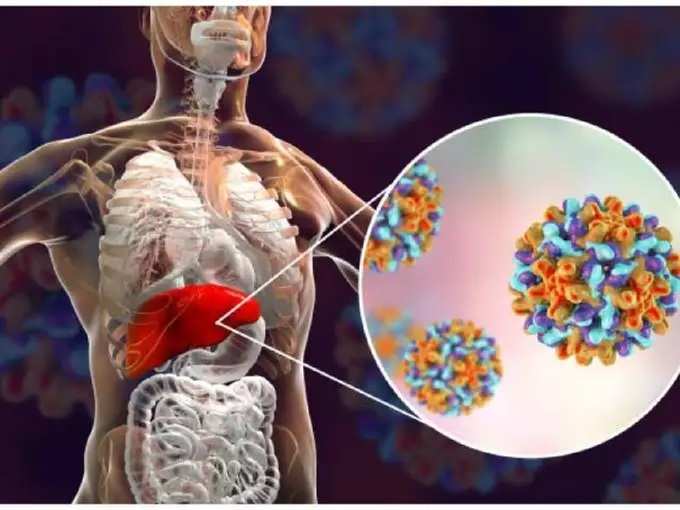 ​हिपॅटायटिस म्हणजे काय? आणि या आजारामागील कारण