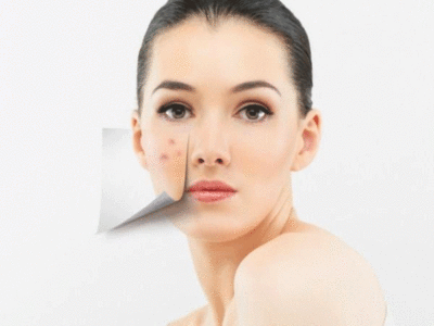 Skin Care Pimple Removal: रातभर में छूमंतर हो जाएगा पिंपल, सोने से पहले लगा लें ये पैच