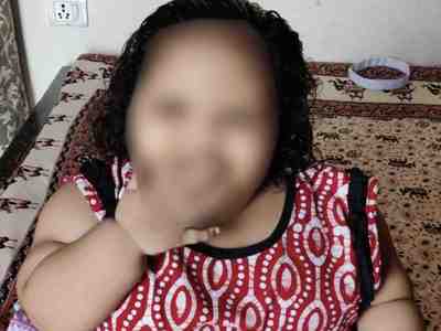 Delhi Child Weight Loss Surgery : उम्र 2 साल, वजन 45 किलो... सांस लेने में दिक्कत होने लगी तो डॉक्टरों ने किया चमत्कार!