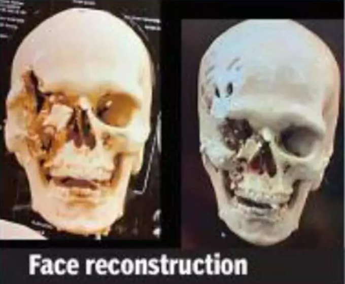 Face reconstruction