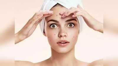 Skin Care Pimple Removal : ‘या’ सोप्या उपायांमुळे एका रात्रीत मुरुमांपासून मिळेल सुटका, चेहऱ्यावरील डागही कायमचे होतील दूर 