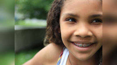 बच्‍चों को किस उम्र में लगवाना चाहिए दांतों में तार, जो सही हो पाएं टेढ़े-मेढ़े दांत