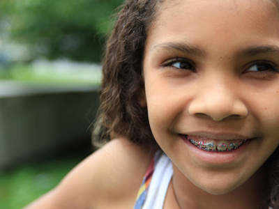 बच्‍चों को किस उम्र में लगवाना चाहिए दांतों में तार, जो सही हो पाएं टेढ़े-मेढ़े दांत