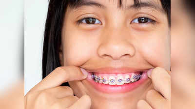 बच्‍चों के दांतों में कीड़ा लगने से बचाना है, तो रोज करें ये 5 काम