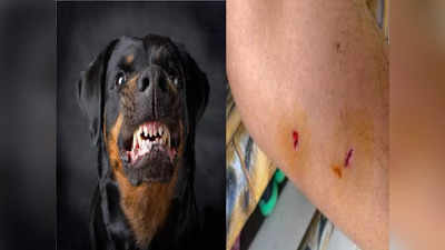 Bihar News: औरंगाबाद में कुत्ता बना लोगों की जान का दुश्मन, एक पागल कुत्ते ने दौड़ा-दौड़ाकर 33 लोगों को काटा