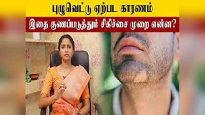 தலையில் புழுவெட்டு பிரச்சனை ஏன் உண்டாகிறது... அதற்கான சிகிச்சை என்ன... இதோ மருத்துவரின் ஆலோசனை..