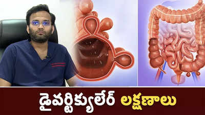 డైవర్టిక్యులేర్ లక్షణాలు 