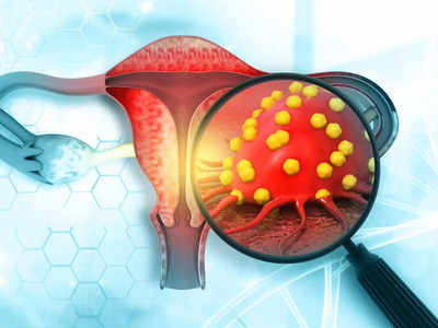 Cervical Cancer: സ്ത്രീകൾ നിസാരമായി കാണാൻ പാടില്ലാത്ത ലക്ഷണങ്ങൾ