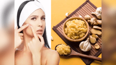 Skin Care Benefits Of Garlic:  एक रात में पिंपल गायब करना है तो इस विधि से करें लहसुन के पेस्ट का उपयोग