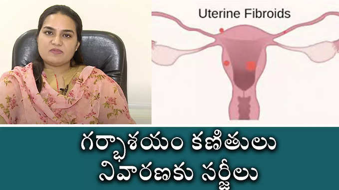 గ‌ర్భాశ‌యం క‌ణితులు నివార‌ణ‌కు స‌ర్జీలు 