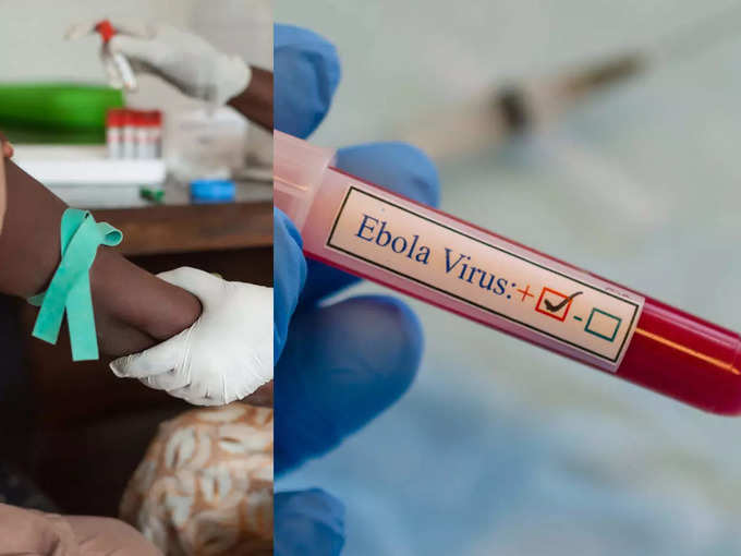 ​इबोला वायरस