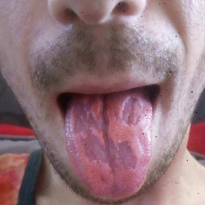 Teacher Who Drank Six Energy Drinks Daily Claims Tongue Damage