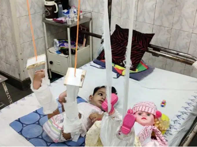 Delhi Doctors Put Plaster On Dolls Legs To Treat Toddlers Fractured Legs CM Arvind Kejriwal Praises