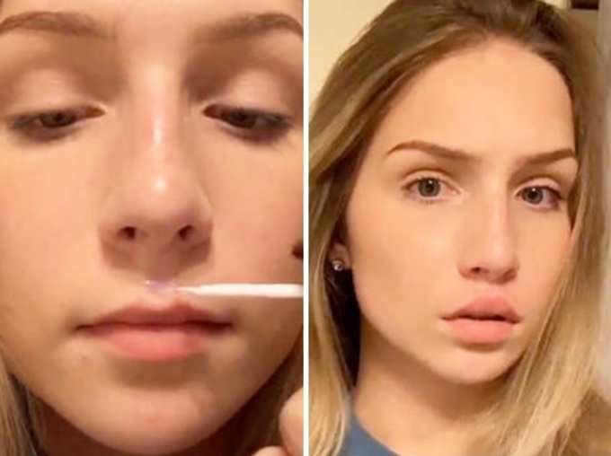 New TikTok challenge Goes Viral Users Glueing Upper Lips to make them look fuller