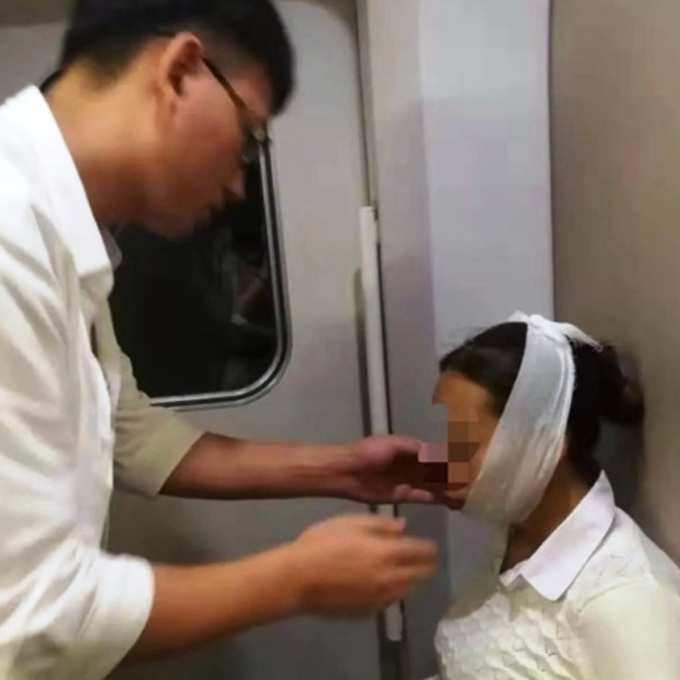 Woman Laughed So Hard That Her Mouth Got Stuck, Jaw Dislocated