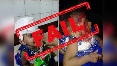ट्रेन में आगज़नी से घायल हुई यह बच्ची? नहीं, यह फोटो बांग्लादेश का है