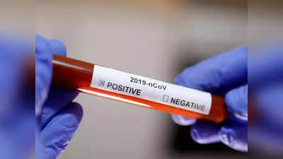 coronavirus latest update करोना: राज्यात आज दैनंदिन रुग्णसंख्या घटली; बरे होणारे रुग्ण वाढले