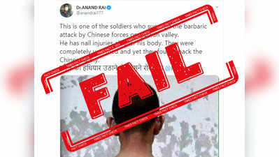 Fake Alert: यह तस्वीर गलवान घाटी में चीनी सेना से झड़प में घायल भारतीय सैनिक की नहीं है