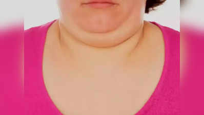 Neck Fat : கழுத்து மட்டும் குண்டா இருக்கா, இதை ஃபாலோ பண்ணுங்களேன், நல்லாவே குறைச்சிடலாம்!