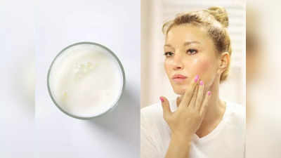 स्वच्छ, नितळ चेहरा हवा तर वापरा हे cleansing milk