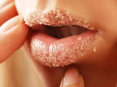 Chapped Lips | ചുണ്ടുകൾ വരണ്ട് പൊട്ടുന്നത് തടയാൻ ഈ കാര്യങ്ങൾ ശ്രദ്ധിക്കൂ