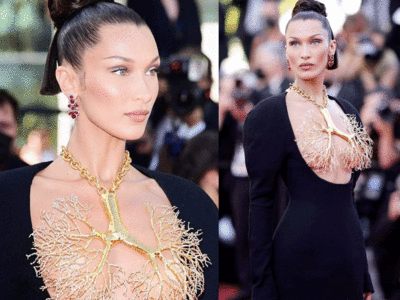 <strong>Bella Hadid Supermodel :</strong> बापरे, अमेरिकेच्या प्रसिद्ध सुपरमॉडेलने या समस्येमुळे गमावला आपला हॉटनेस, रडत रडत शेअर केले फोटो व कहाणी! 