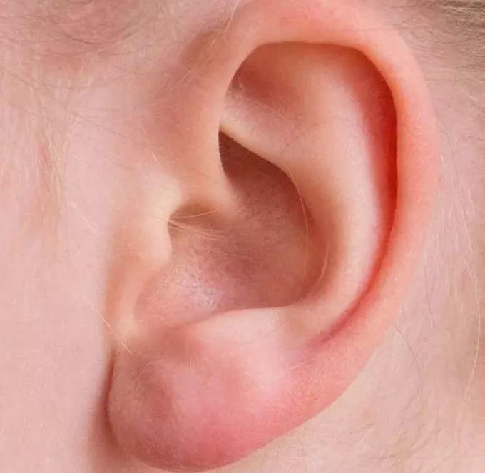 How to Safely Clean Your Ears​:​ ​অবহেলা নয়, কানের ময়লা পরিষ্কার করার আগে পড়ুন এই প্রতিবেদন​