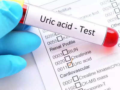 Uric Acid Treatment At Home : യൂറിക് ആസിഡ് കുറയ്ക്കാന്‍ നാച്വറല്‍ വിദ്യകള്‍....